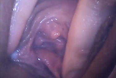 What happens inside the vagina during sex and orgasm